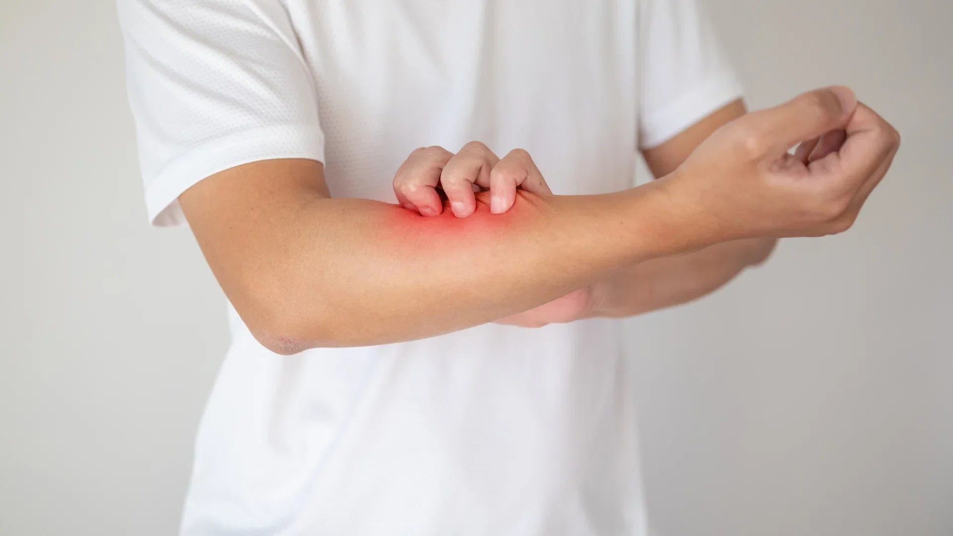 Peut-on réduire l’eczéma avec un filtre de douche ?